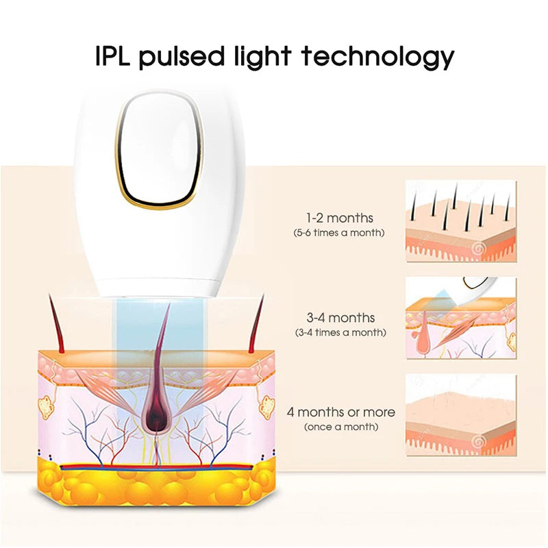 Epilateur laser